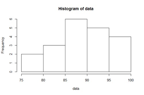 R Histogram