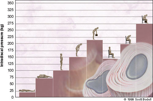 Intradiscal Pressure